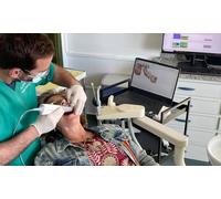 Limpieza dental airflow para la eliminación de manchas con radiografía panorámica y escáner intraoral