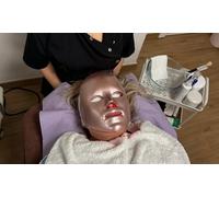 Limpieza facial microdermoabrasión con punta de diamante y 1 sesión de tratamiento IPL facial