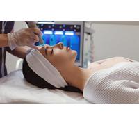 Limpieza facial profunda con dispositivo de hidrolimpieza radiofrecuencia y ultrasonido