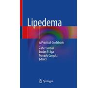 Lipedema: A Practical Guidebook