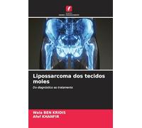 Lipossarcoma dos tecidos moles: Do diagnóstico ao tratamento