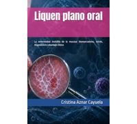 Liquen plano oral: La enfermedad invisible de la mucosa: biomarcadores, estrés, diagnóstico y abordaje clínico