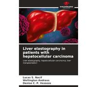 Liver elastography in patients with hepatocellular carcinoma: Liver elastography, hepatocellular carcinoma, liver transplantation