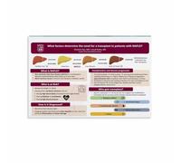 Liver Health Awareness Poster Vital Organ Care Guide Educational Wall Art Chart for Clinic Office Home Decor(Unframed,16x24inch(40x60cm))