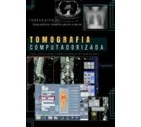 Livro De Tomografia Computadorizada (ebook)