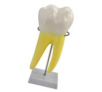 Ljmyy Modelo de anatomía molar humana, modelo de enseñanza molar humano con base estable para enseñanza dental y educación médica