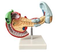 LKYLVEE Modelo de Anatomía de Páncreas y Bazo - Modelo Anatómico de Órgano Humano - Modelo Pancreático, Esplénico y Duodenal para Estudio y Exhibición,Pathological,20cm