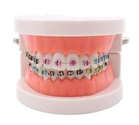 LKYLVEE Modelo de demostración de ortodoncia Dental - Modelo de Dientes estándar - Modelo de Tratamiento con Bracket metálico, Modelo explicativo,C,8cm