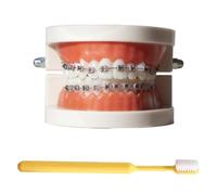 LKYLVEE Modelo de demostración ortodóntica Dental Modelo de Tratamiento de Dientes estándar con Soporte de Metal, Alambre de Arco Explicación del Modelo con Brackets, con Cepillo de Dientes