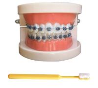 LKYLVEE Modelo de demostración ortodóntica Dental Modelo de Tratamiento de Dientes estándar con Soporte de Metal, Alambre de Arco Explicación del Modelo con Brackets, con Cepillo de Dientes