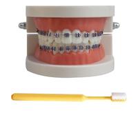 LKYLVEE Modelo de demostración ortodóntica Dental Modelo de Tratamiento de Dientes estándar con Soporte de Metal, Alambre de Arco Explicación del Modelo con Brackets, con Cepillo de Dientes