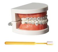 LKYLVEE Modelo de demostración ortodóntica Dental Modelo de Tratamiento de Dientes estándar con Soporte de Metal, Alambre de Arco Explicación del Modelo con Brackets, con Cepillo de Dientes