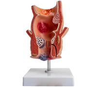 LKYLVEE Modelo de Patología Rectal Humana - Modelo Anatómico de Lesión Rectal - Órganos Viscerales para Cirugía de Colon y Recto para Enseñanza y Exhibición,Flesh,20CM