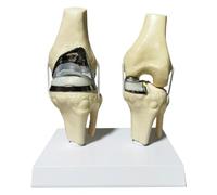 LKYLVEE Modelo de Rodilla Cartílago Artificial Modelo de Articulación de Rodilla Prótesis Modelo de Reemplazo de Rodilla Modelo de Menisco,D,15cm