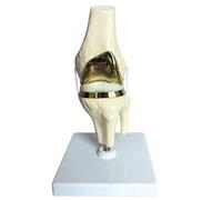 LKYLVEE Modelo de Rodilla Cartílago Artificial Modelo de Articulación de Rodilla Prótesis Modelo de Reemplazo de Rodilla Modelo de Menisco,A,15cm