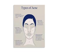 LLBOGRGGN Educational Skincare Poster Facial Acne Mapping Guide Location Based Causes Canvas Wall-Art for Living Room Decor(Unframed,16x24inch(40x60cm))