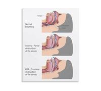 LLBOGRGGN Sleep Apnea Health Guide Educational Awareness Poster Canvas Print Wall-Art for Bedroom Living Room Clinic Decor(Framed,12x18inch(30x45cm))