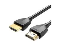 LOKLNEYK Cable Divisor De Audio 4K 3D HD 2.0, Compatible con Vention, PS4/3, Proyector, HDTV Y Xbox.(PVC Shell,3m)