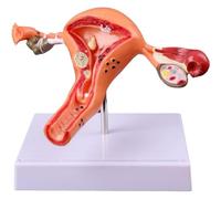 Lpitoy Modelo De Útero Y Ovario Femenino Humano, Órgano Genital Femenino, Modelo De Órgano Reproductivo, Enseñanza Médica Uterina, Ginecología Anatómica, Modelo De Ovario De Útero