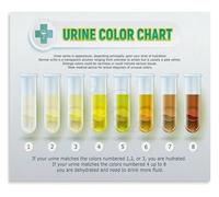 LTRAJUYNH Urine Color Chart Poster Knowledge Poster for Bedroom Living Room Gym Wall-Art Hydration Level Chart Health Gift Idea No Frame(Framed,08x12inch(20x30cm))