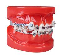 LUCKFY Dental Tipodonto Adulto Demostración Modelo de los Dientes con los Dientes Mental Brackets de ortodoncia Modelo con Ligadura Corbatas Rojas
