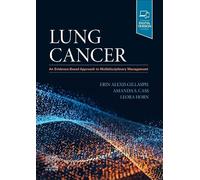 Lung Cancer: An Evidence-Based Approach to Multidisciplinary Management