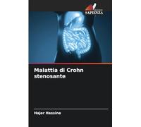 Malattia di Crohn stenosante