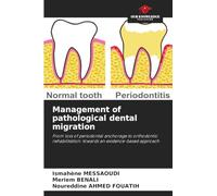 Management of pathological dental migration: From loss of periodontal anchorage to orthodontic rehabilitation: towards an evidence-based approach