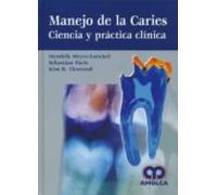 Manejo De La Caries: Ciencia Y Practica Clinica