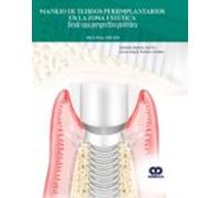 Manejo De Tejidos Periimplantarios En La Zona Estetica: Desde Una Pers