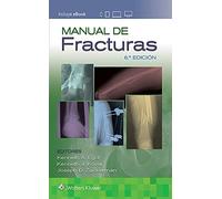 Manual de fracturas (Spanish Edition)