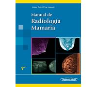 Manual de Radiología Mamaria