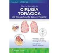 Manual Ilustrado De Cirugía Torácica De Massachusetts General Hos Pita