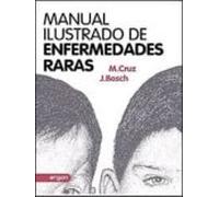 Manual Ilustrado De Enfermedades Raras