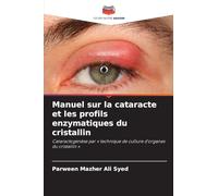 Manuel sur la cataracte et les profils enzymatiques du cristallin: Cataractogenèse par ' technique de culture d'organes du cristallin '