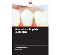 Manuel sur la péri-implantite