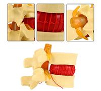 Marhynchus Modelo Lumbar Médico para la Demostración de la Operación, Generalizado para Ergonomía y Enseñanza Clínica