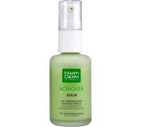 Martiderm Acniover El suero antiimperfecciones equilibra y regula 30mL