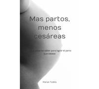 Mas partos, menos cesáreas: lo que deberías saber para lograr el parto que deseas