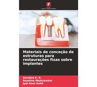Materiais de conceção de estruturas para restaurações fixas sobre implantes