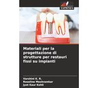 Materiali per la progettazione di strutture per restauri fissi su impianti