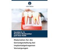 Materialien für die Gerüstgestaltung bei implantatgetragenen Versorgungen
