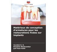 Matériaux de conception d'armatures pour les restaurations fixées sur implants