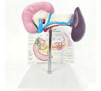 Mavdecll Modelo De Anatomía del Páncreas Humano con Vesícula Biliar Y Bazo, Modelo De Bazo Sano con Tarjeta Trasera En Inglés, Visualización del Tronco Celíaco del Duodeno, para Enseñanza Médica