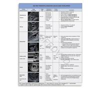 MCQWOMFQAK Early Pregnancy Ultrasound Dictionary Poster First Trimester Sonography Terms Guide for Learning(Unframed,08x12inch(20x30cm))