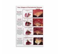 MDBJTCYZN Dog Periodontal Disease Chart Poster Educational Stages of Canine for Vet Office Animal Clinic Decor(Framed,12x18inch(30x45cm))