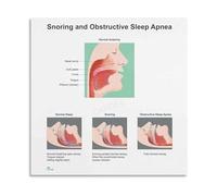 MDBJTCYZN Health Education Poster Upper Airway Anatomical Chart Sleep Disorder Reference Clinic Decor Office Wall-Art for Staff(Framed,12x18inch(30x45cm))