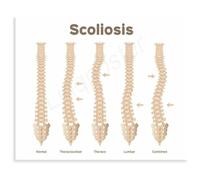 MDBJTCYZN Posture Awareness Chart Spinal Health Reference Guide Canvas Wall-Art Poster for Study Room Office Decor(Unframed,12x18inch(30x45cm))