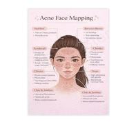 MDBJTCYZN Professional Acne Face Mapping Chart Poster Skincare Facial Analysis Guide Canvas Wall-Art for Living Room Bedroom(Unframed,08x12inch(20x30cm))