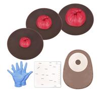 MedEduQuest Simuladores de colostomía pegajosa, juego de modelos de entrenamiento de estoma, modelos de práctica de cuidado de ostomía de tono múltiple para entrenamiento médico y educación del